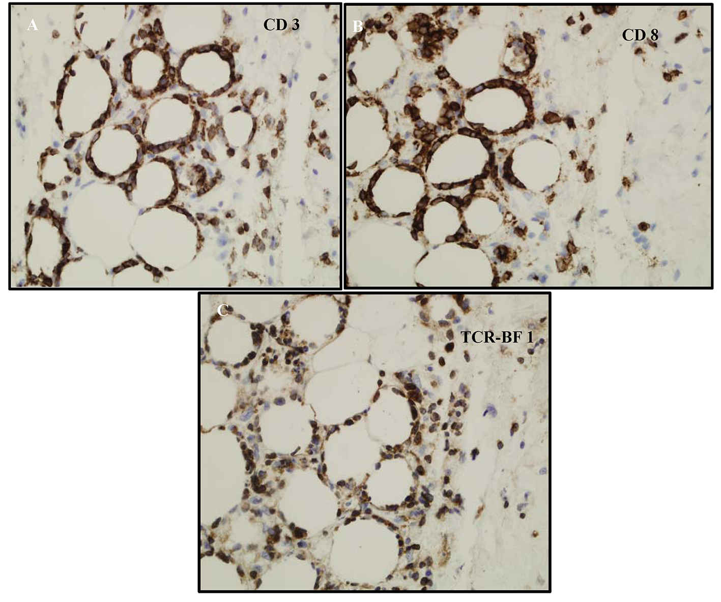 Cd3 Mature T Cells